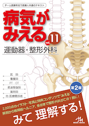 病気がみえるvol.11（書籍版）