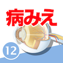 病気がみえる12
