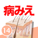 病気がみえる14